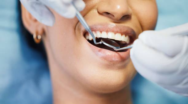 Best Emergency Dental Care for Broken or Chipped Teeth in Palisade, CO